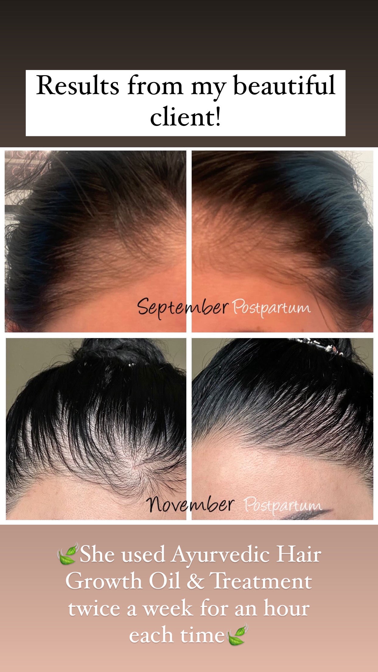 Ayurvedic Hair Growth Oil & Treatment