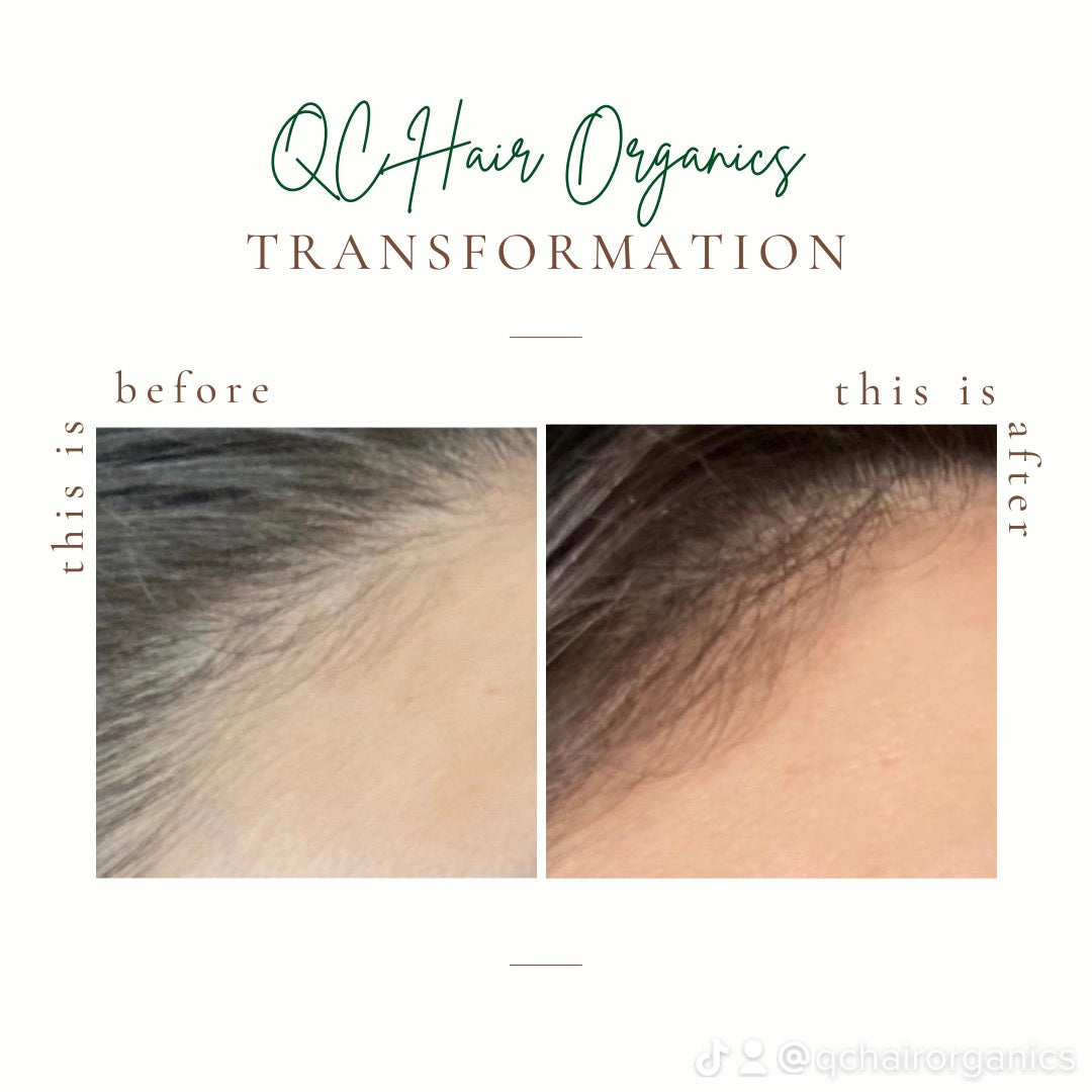 Hair Growth Set