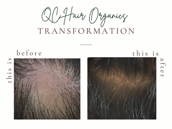 Hair Growth Set