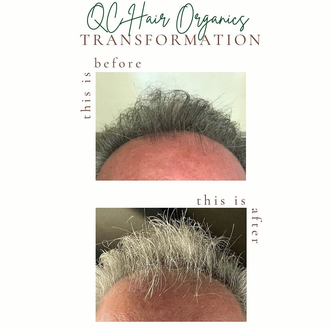 Hair Growth Set